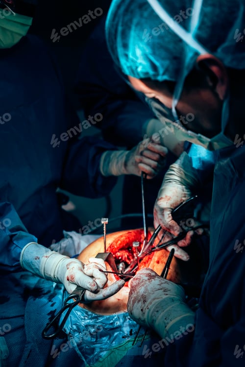 Preview: Surgeons Performing Invasive Procedure in Hospital Operating Room
