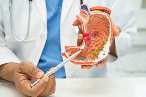 Preview: Stomach disease, doctor with human anatomy model for study diagnosis and treatment in hospital.