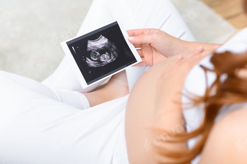 Preview: cropped view of pregnant woman holding ultrasound scan of unborn baby