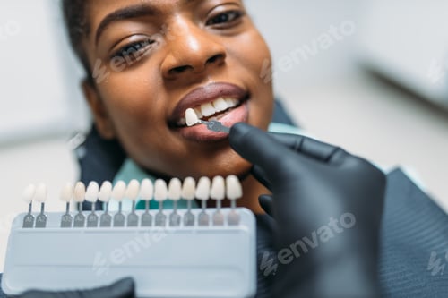 Preview: Choosing shade of teeth procedure, dental clinic