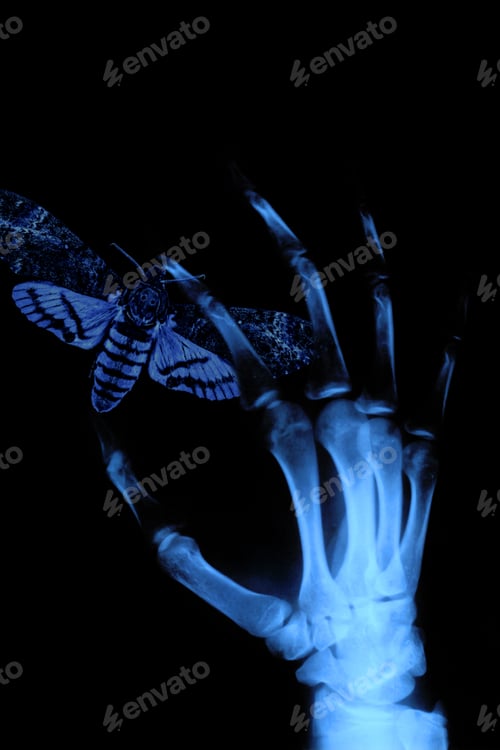 Preview: X-ray hand