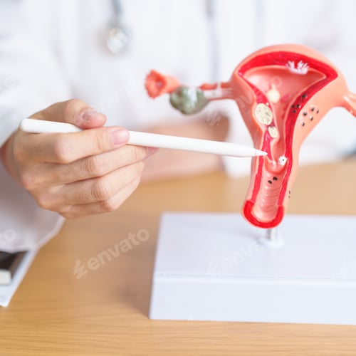 Preview: Doctor Explains Uterus Model Using Digital Pen