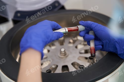 Preview: Medical worker prepearing for research with centrifuge in hospital