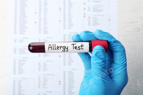 Preview: Doctor holding glass tube with blood over table, top view. Allergy test