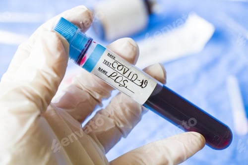 Preview: High angle shot of a blood test sample with positive result in a doctor hand with white gloves