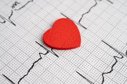 Preview: Red heart on electrocardiogram ECG with red heart, heart wave, heart attack, cardiogram report.