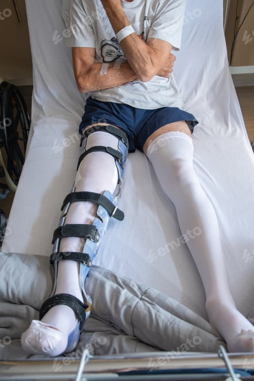 Preview: man with broken leg in an orthosis on bed in a clinic after an accident and a fracture of the femur