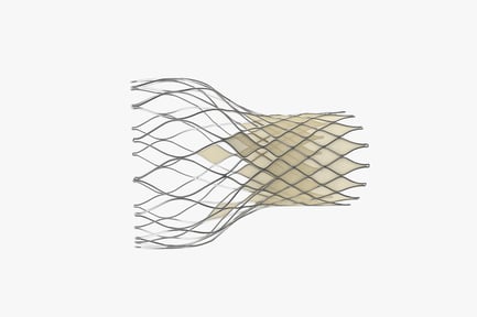 Preview: Aortic Valve Stent Implant