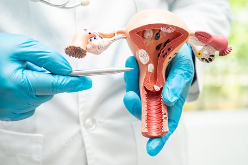 Preview: Uterus, doctor holding anatomy model for study diagnosis and treatment in hospital.