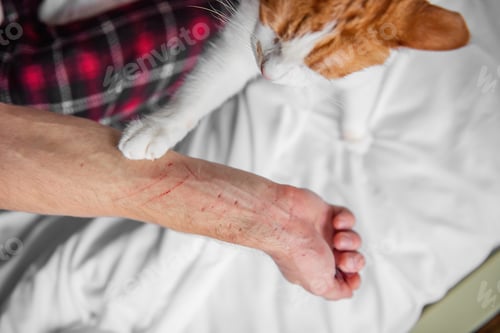 Preview: Rabid white-red cat furiously scratched, bit through the mans hand until it bled. Pet attack.
