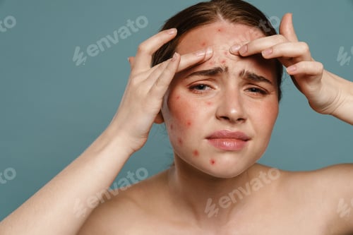 Preview: Ginger shirtless woman frowning and squeezing pimple on her face
