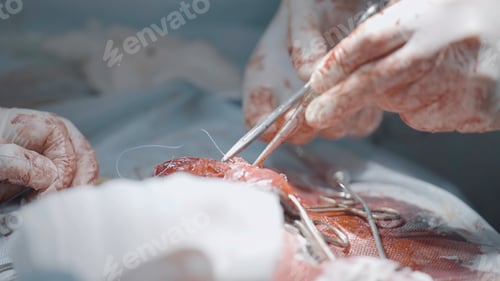 Preview: Surgeons cutting flesh. Action. Close-up of surgical intervention in male genital organ. Bloody