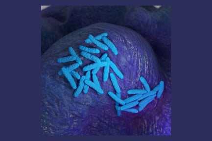 Preview: Shigella Bacterium Detail