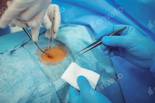 Preview: Team of surgeons performing operation in operation theater