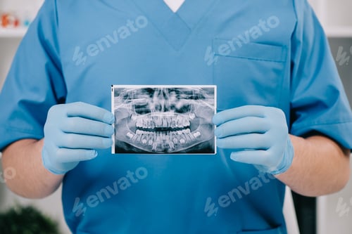 Preview: cropped view of orthodontist holding teeth x-ray in clinic