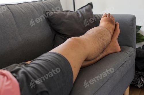 Preview: Unrecognized Male With Severely Swollen Leg Resting And Lying On Sofa