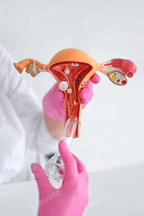 Preview: Close-up of gynecology anatomy model showing uterus, cervix and ovaries in doctor hands.