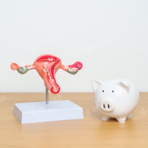 Preview: Uterus and Ovaries model with Piggy Bank