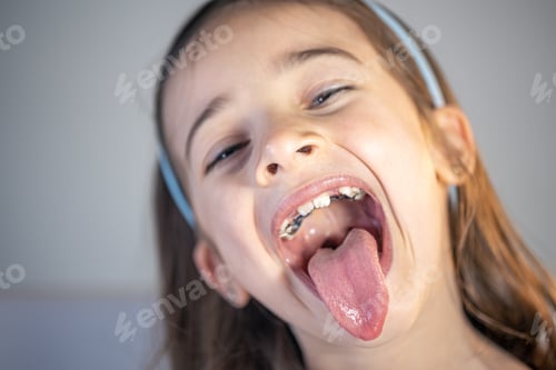 Preview: A child girl open her mouth and show her tounge.