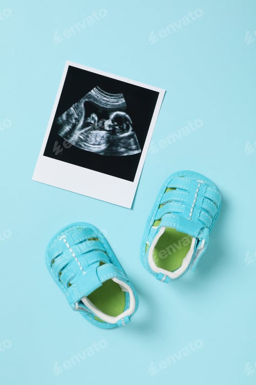 Preview: Concept of maternity, parenting and pregnancy, top view