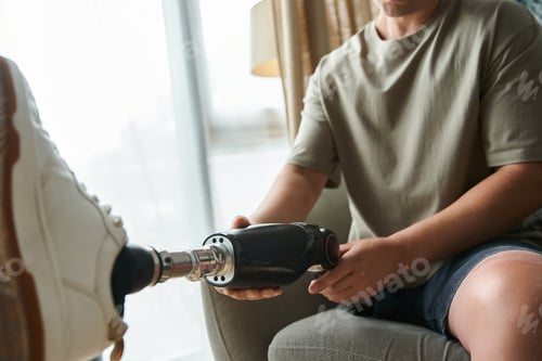 Preview: Young man with prosthetic leg adjusting his device in a modern living room