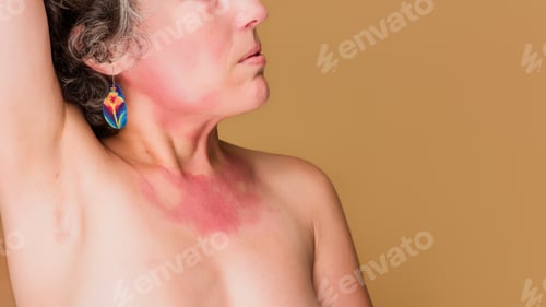 Preview: Middle aged woman accepting skin condition, feeling positive body image