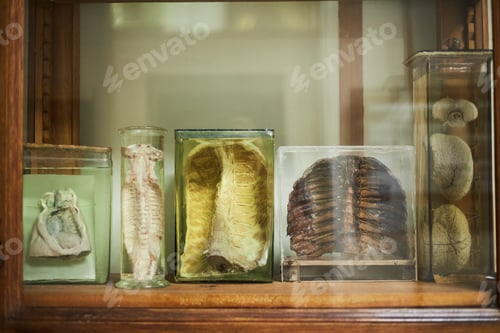 Preview: Human Anatomical Specimens Preserved in Glass Jars Displayed in Museum Exhibit