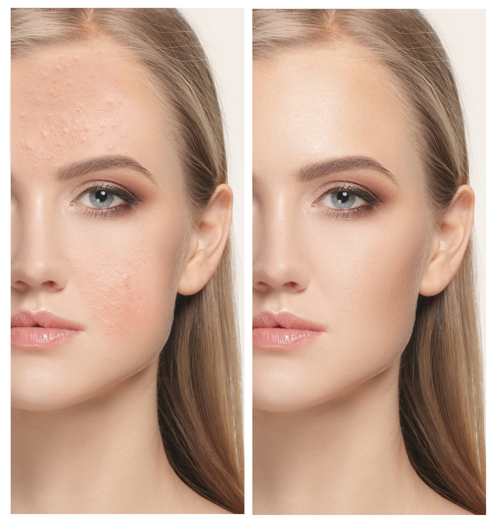 Before and after beauty photo comparison