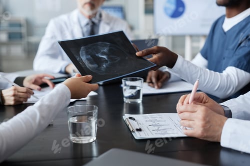 Preview: Hand of young black man in blue uniform passing x-ray image to colleague
