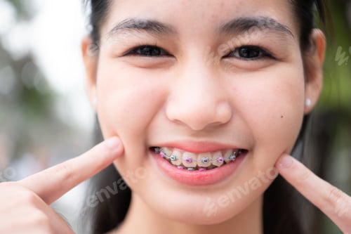 Preview: Portrait of a young asian woman with braces on her teeth