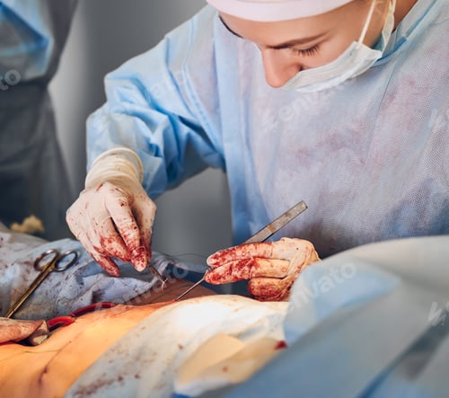 Preview: Surgeon Performing a Procedure in Hospital Operating Room