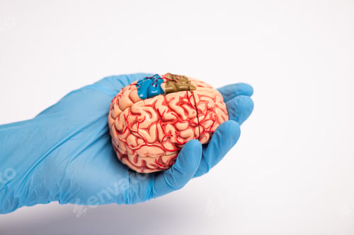 Preview: High angle view of doctor holding brain model with colored parts on white background, alzheimer