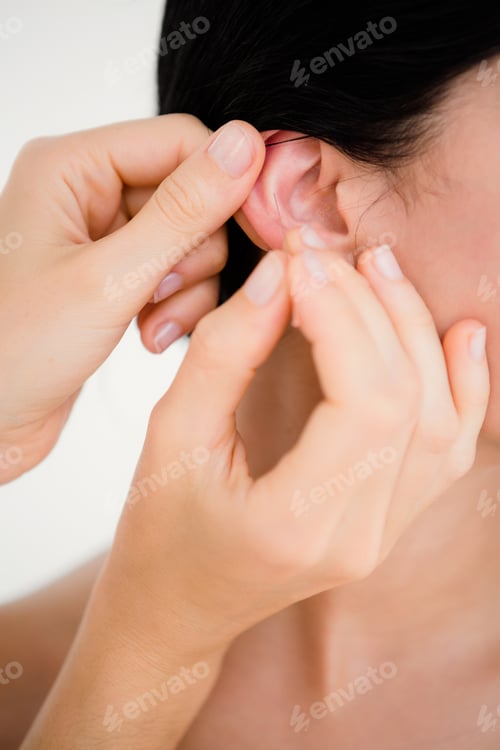Preview: Close up view of woman holding a needle in an acupuncture therapy