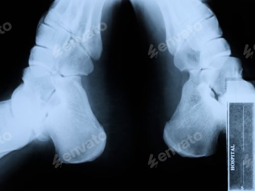 Preview: Details of X Ray Frame from Hospital