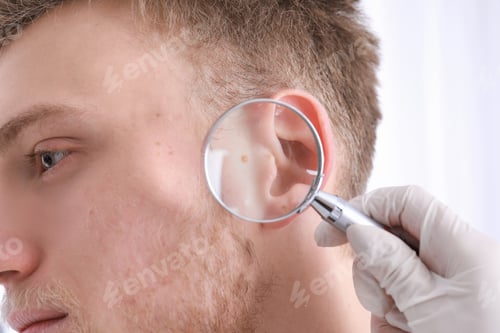Preview: Dermatologist examining patient with magnifying glass in clinic, closeup view