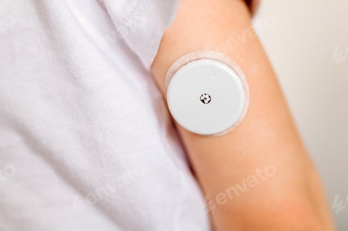 Preview: CGM -system of continuous monitoring of glucose on child's arm.