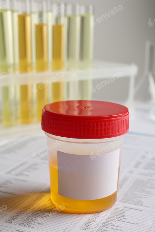 Preview: Container with urine sample for analysis on table
