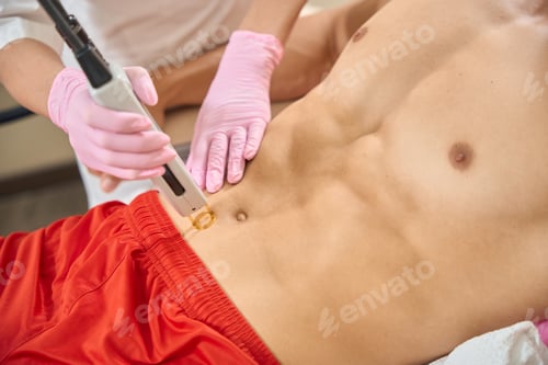 Preview: Beauty salon client at laser hair removal session in abdomen