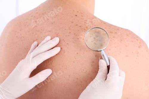 Preview: Dermatologist examining patient with magnifying glass in clinic, closeup view