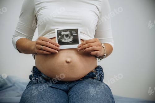 Preview: Pregnant woman is in the clinic and holding image of ultrasonic test, conception of anticipation