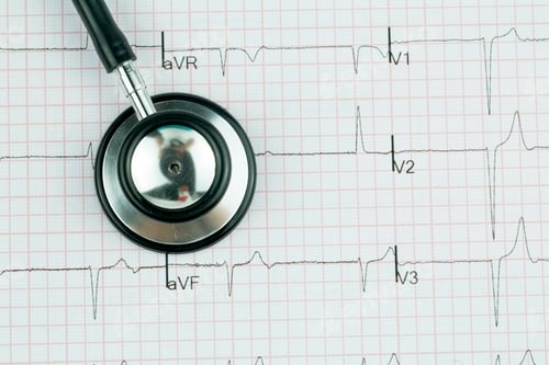 Preview: Stethoscope on the electrocardiogram (ECG) graph (top view)