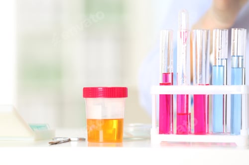 Preview: Rack with test tubes and jar on table in laboratory. Research and analysis