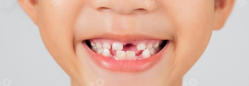 Preview: A child grins, revealing a missing tooth. The dentist discusses tooth loss and proper dental care