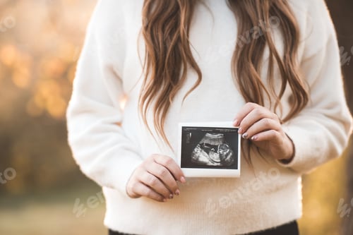 Preview: Pregnant woman holding x-ray of tummy