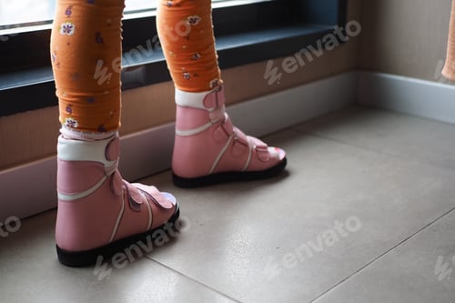 Preview: Child cerebral palsy disability, legs orthosis.