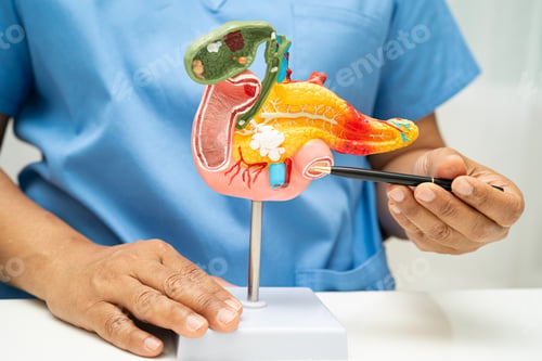 Preview: Pancreatitis, pancreatic cancer, Asian doctor with pancreas, gallbladder