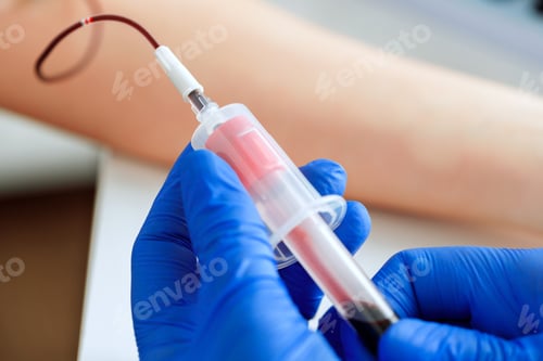 Preview: Hands of a doctor taking blood samples using a tube holder