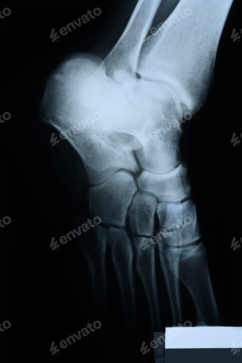 Preview: Anble X-ray detail