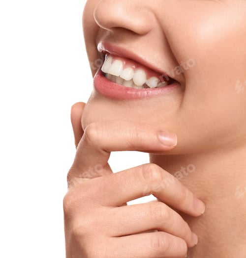 Preview: Young woman with beautiful smile on white background, closeup. Teeth whitening