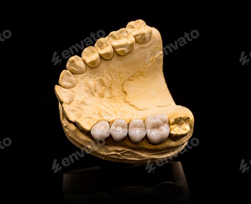 Preview: Artificial teeth